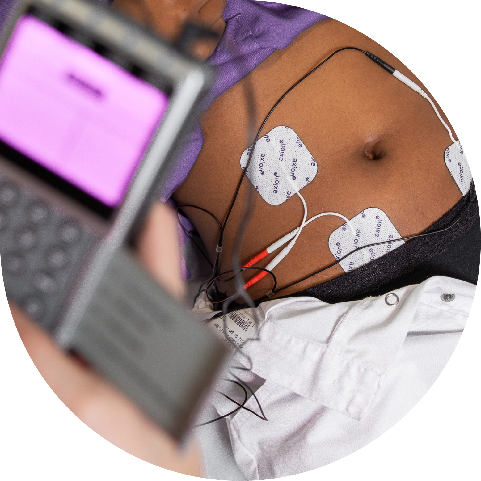 Dolomed-Endometriose-Sprechstunde