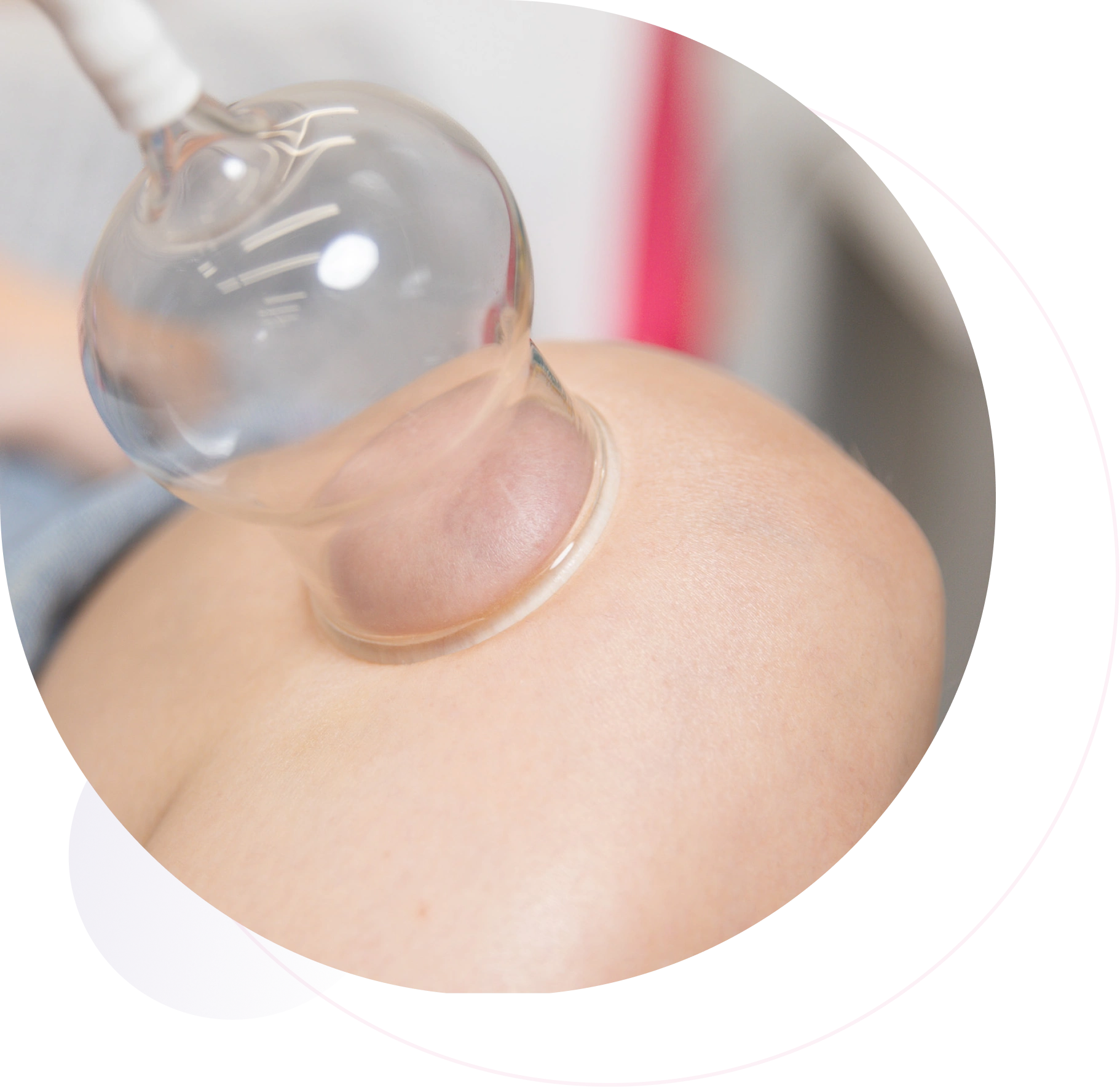 Dolomed-Vorteile-der-pulsierenden-Schropftherapie